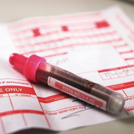 Quais são os valores normais de eosinófilos no sangue - Função e causas