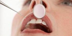 Quais são os sintomas da candidíase oral