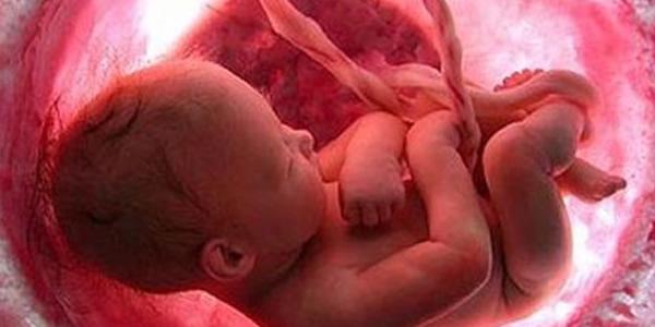 Como acontece a trombose no cordão umbilical