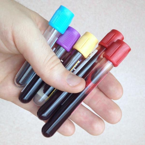 Pode ter relação antes de fazer exame de sangue?
