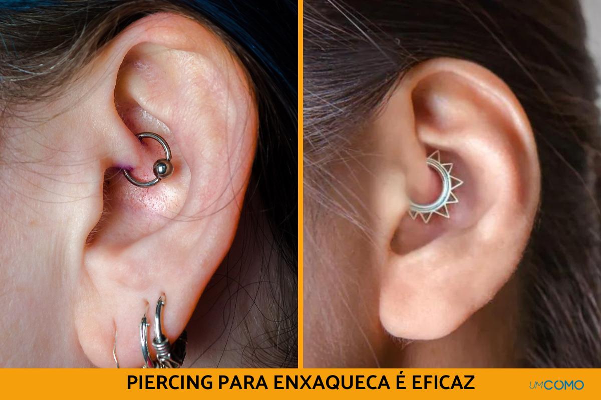 Piercing para enxaqueca (daith piercing) é eficaz?