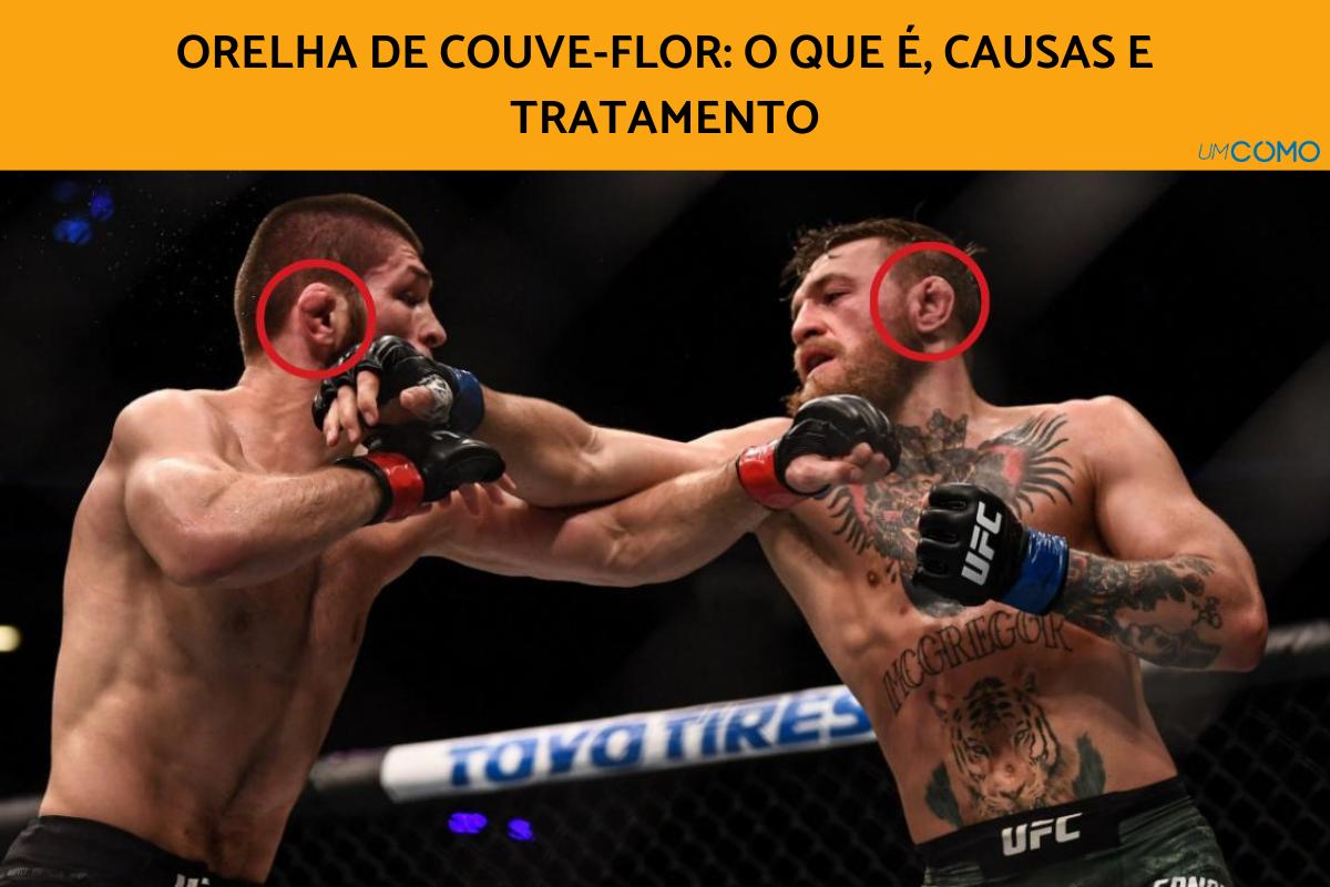 Orelha de couve-flor: o que é, causas e tratamento
