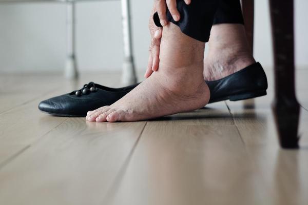Por que os pés incham? - Doença renal