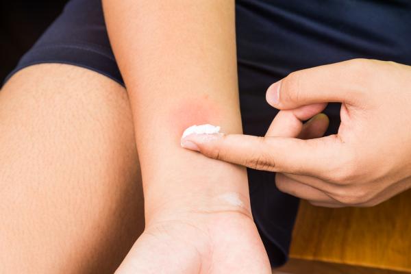 Como eliminar espinhas nos braços - Passo 5