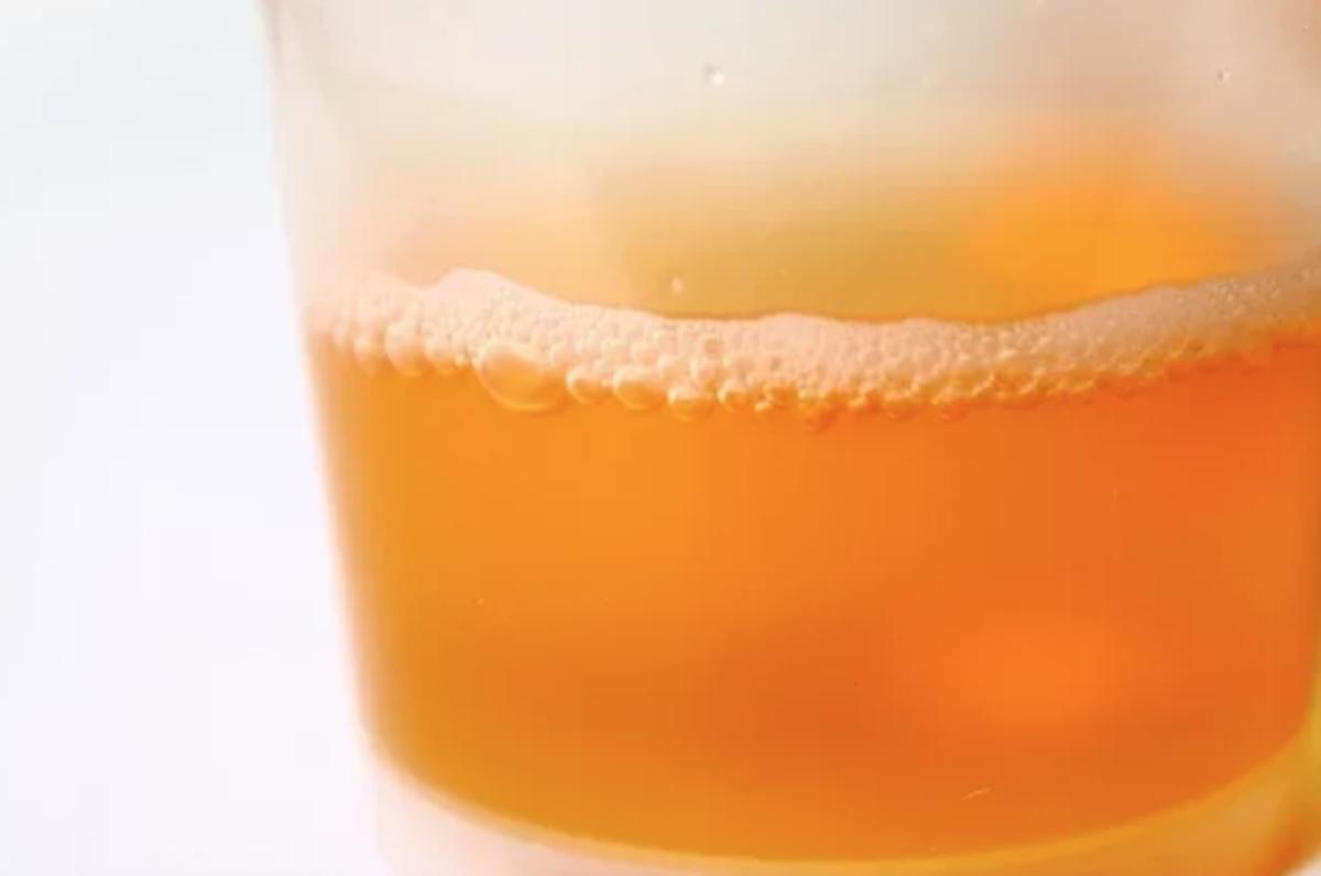 O que fazer quando a urina está espumando