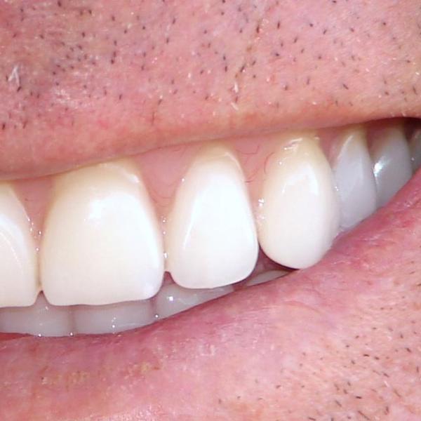 Como escovar os dentes com sabão
