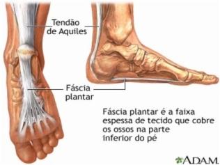 Porque o meu calcanhar dói - Fascite plantar