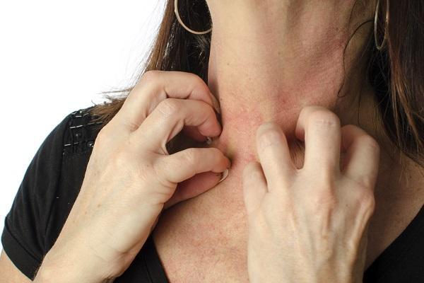15 sinais que podem indicar problema no fígado - Passo 4