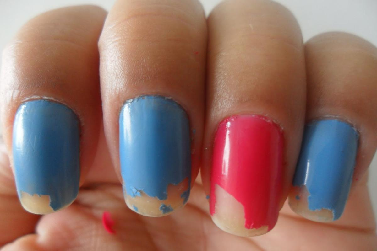 O que fazer quando o esmalte descasca