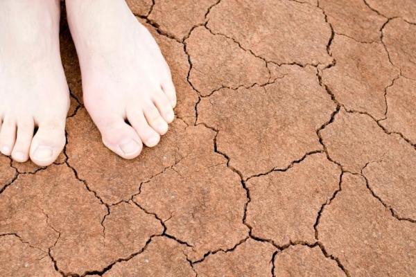Como tirar a pele seca dos pés
