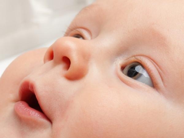 Como identificar estrabismo no bebê