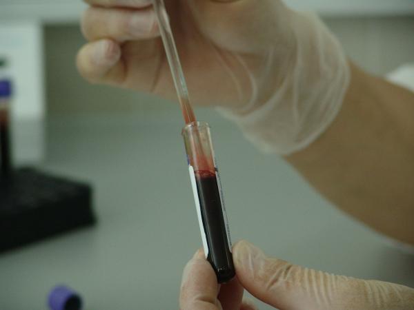 Lipase alta no exame de sangue - O que pode ser?