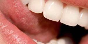 O que significa sonhar que os dentes estão caindo