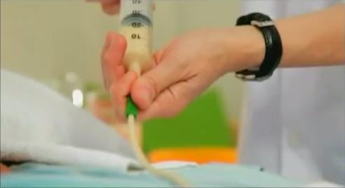Como alimentar uma pessoa com sonda - Passo 5