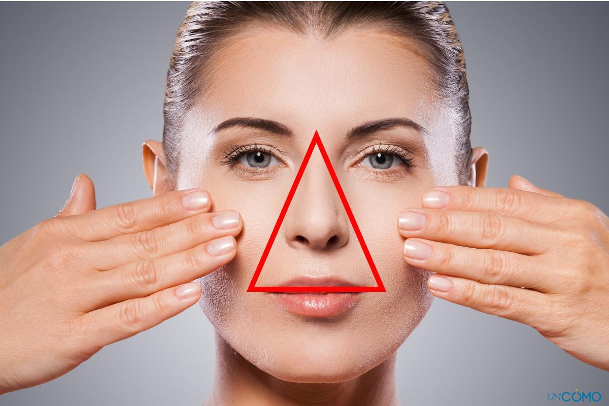 Triângulo perigoso da face: qual é e por que deve-se ter cuidado ao espremer uma espinha